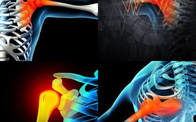 Study Suggests Alleviating Musculoskeletal Pain Could Reduce Risk of Chronic Disease